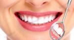 Гигиеническая чистка зубов 750 руб. вместо 3000 руб. СКИДКА 75%