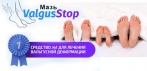 Мазь от косточки на ноге ValgusStop. СРЕДСТВО №1 ДЛЯ ЛЕЧЕНИЯ ВАЛЬГУСНОЙ ДЕФОРМАЦИИ!