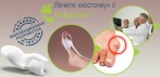 На ортопедический фиксатор «ValgusLux». Эффективно снимает боль и припухлость!