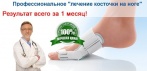 Профессиональное лечение косточки на ноге ValuFix. Здоровые и красивые ножки без врачей и операций!