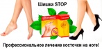 На крем «ШИШКА STOP». Эффективен как при начальной, так и при выраженной стадиях деформации сустава!