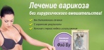 Пластырь от варикоза и васкулита. Ключ к эффективному лечению варикоза без операций!