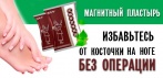 На магнитный пластырь от вальгусной деформации. Избавьтесь от косточки на ноге без операции!