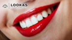 Скидки до 70% на отбеливание зубов в салоне красоты Lookas. 850 р. за отбеливание до 6 тонов по шкале Vita
